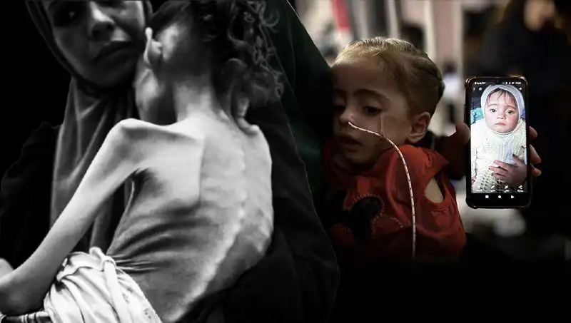 Küçük Meryem'in Hayatta Kalma Mücadelesi: 25 Kilodan 10 Kiloya Düştü